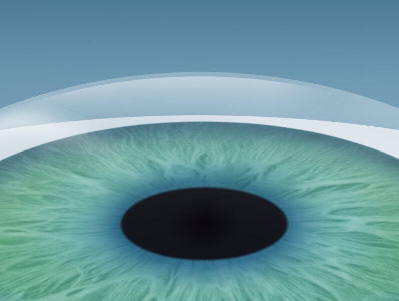 3. Schritt der SMILE Pro OP-Augenlasern für Sportler, sicher und risikoarm in Graz, Steiermark und Umgebung